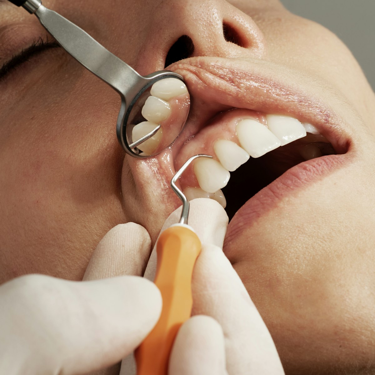 Professional dental care and treatment